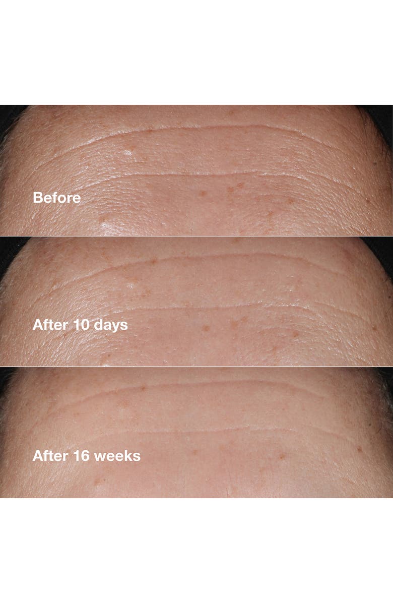 Clinique Smart Clinical Repair<sup>™</sup> Wrinkle Correcting Serum, Alternate, color,