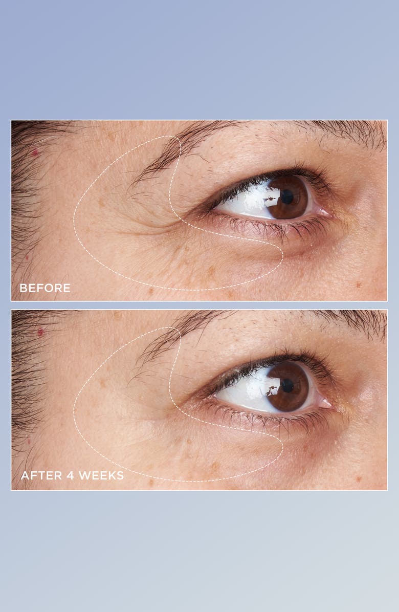 Perricone MD HIGH POTENCY Triple Retinol Renewal Eye Serum, Alternate, color,