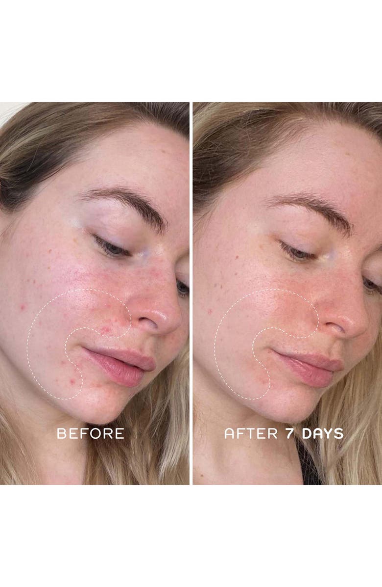 REN Clean Skincare Steady Glow Daily AHA Tonic Resurfacing Toner, Alternate, color,