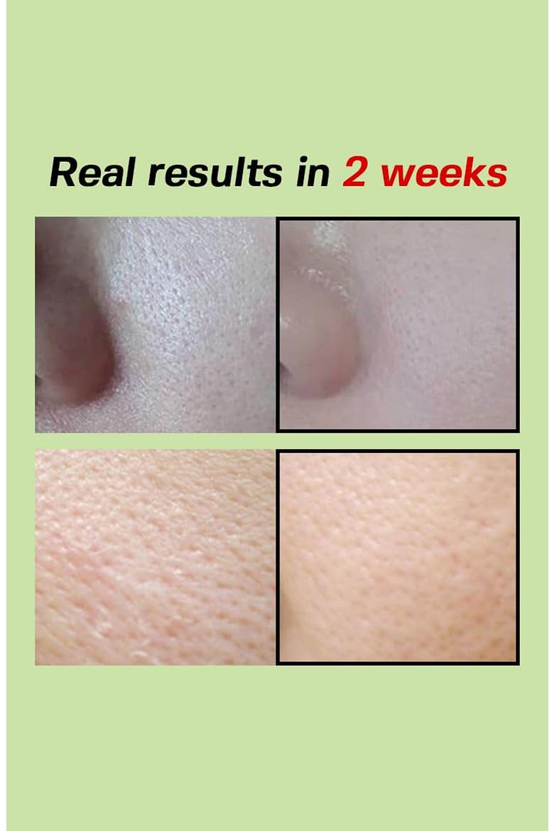 Green Tomato NMN Pore Minimizing Ampoule, Alternate, color, NO COLOR