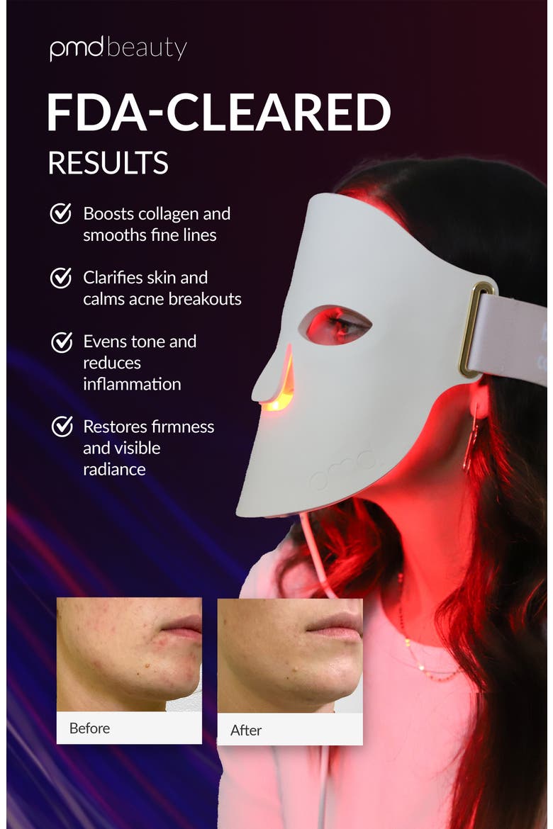 LED Light Therapy Mask, Alternate, color, CREAM