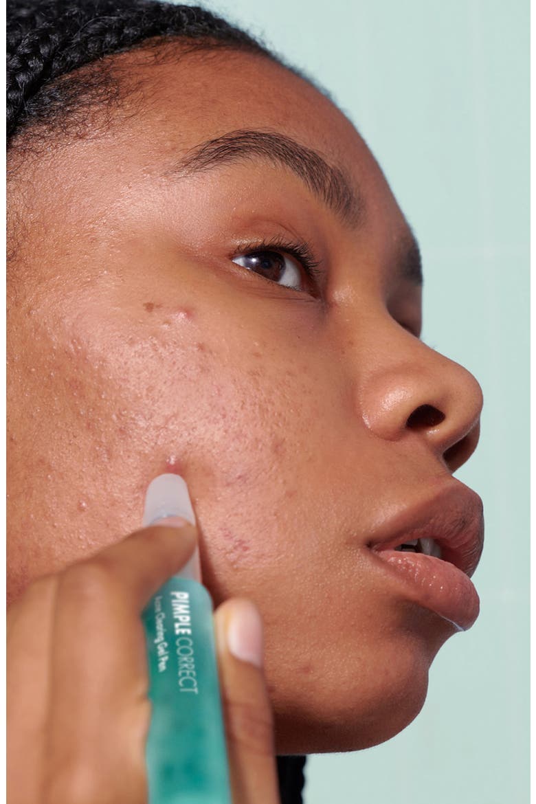 Pimple Correct, Alternate, color, NO COLOR