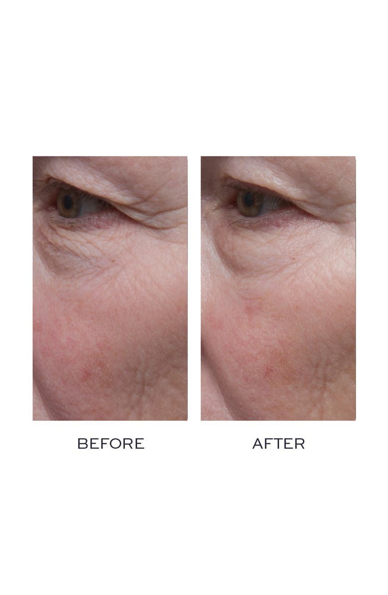 Elemis Pro-Definition Eye and Lip Contour Cream, Alternate, color, 