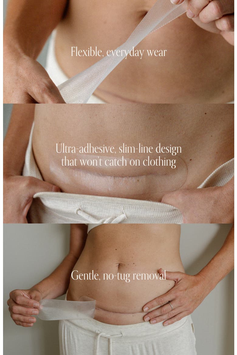C-Section Scar Care Kit, Alternate, color, No color