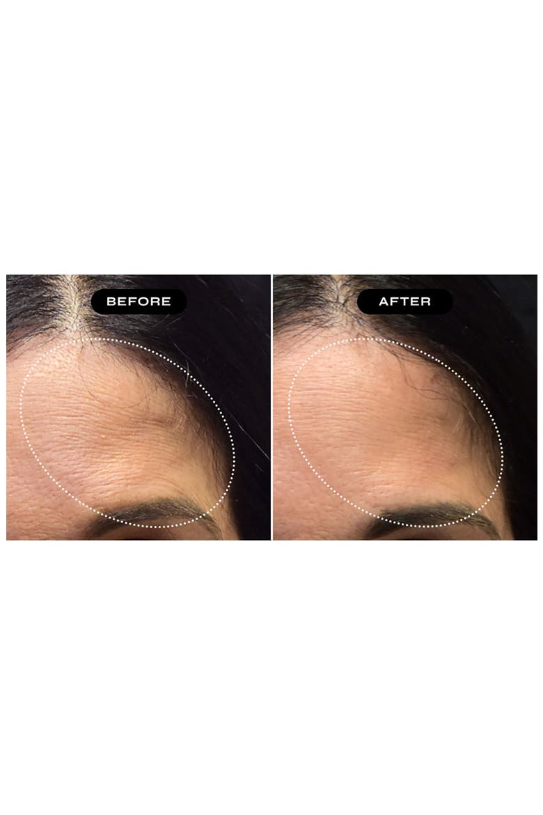 Exoglow Multi-Action Face Serum, Alternate, color, NO COLOR