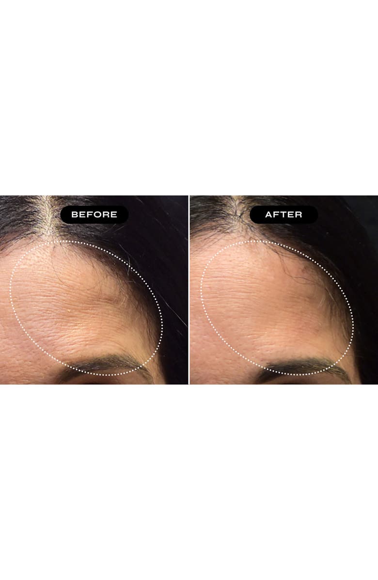 NakedBeauty MD Exoglow Multi-Action Face Serum, Alternate, color, 