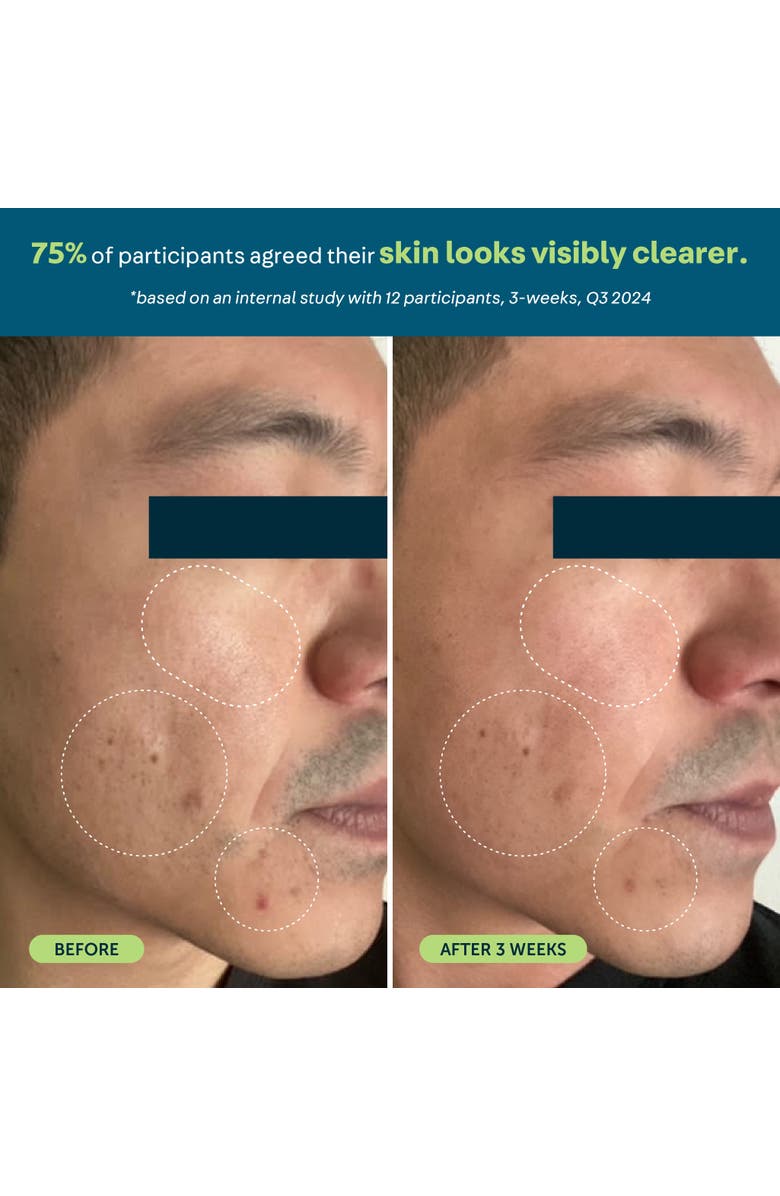 OARS + ALPS Anti-Everything Face Serum, Alternate, color, Blue