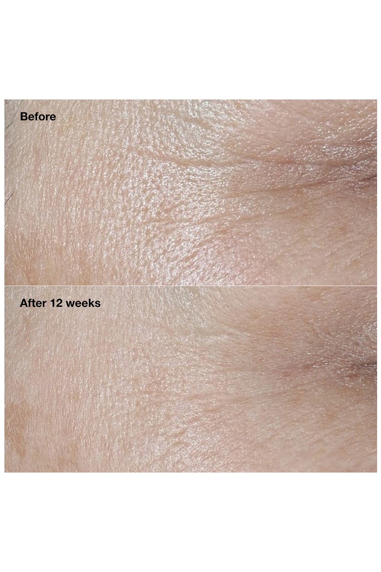 Smart Clinical Repair Broad Spectrum SPF 30 Wrinkle Correcting Face Cream, Alternate, color, NO COLOR