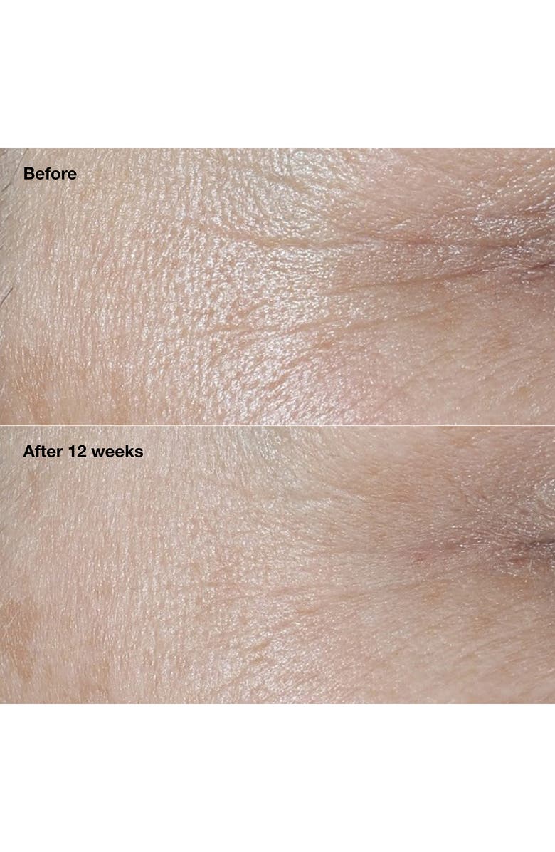 Clinique Smart Clinical Repair Broad Spectrum SPF 30 Wrinkle Correcting Face Cream, Alternate, color,