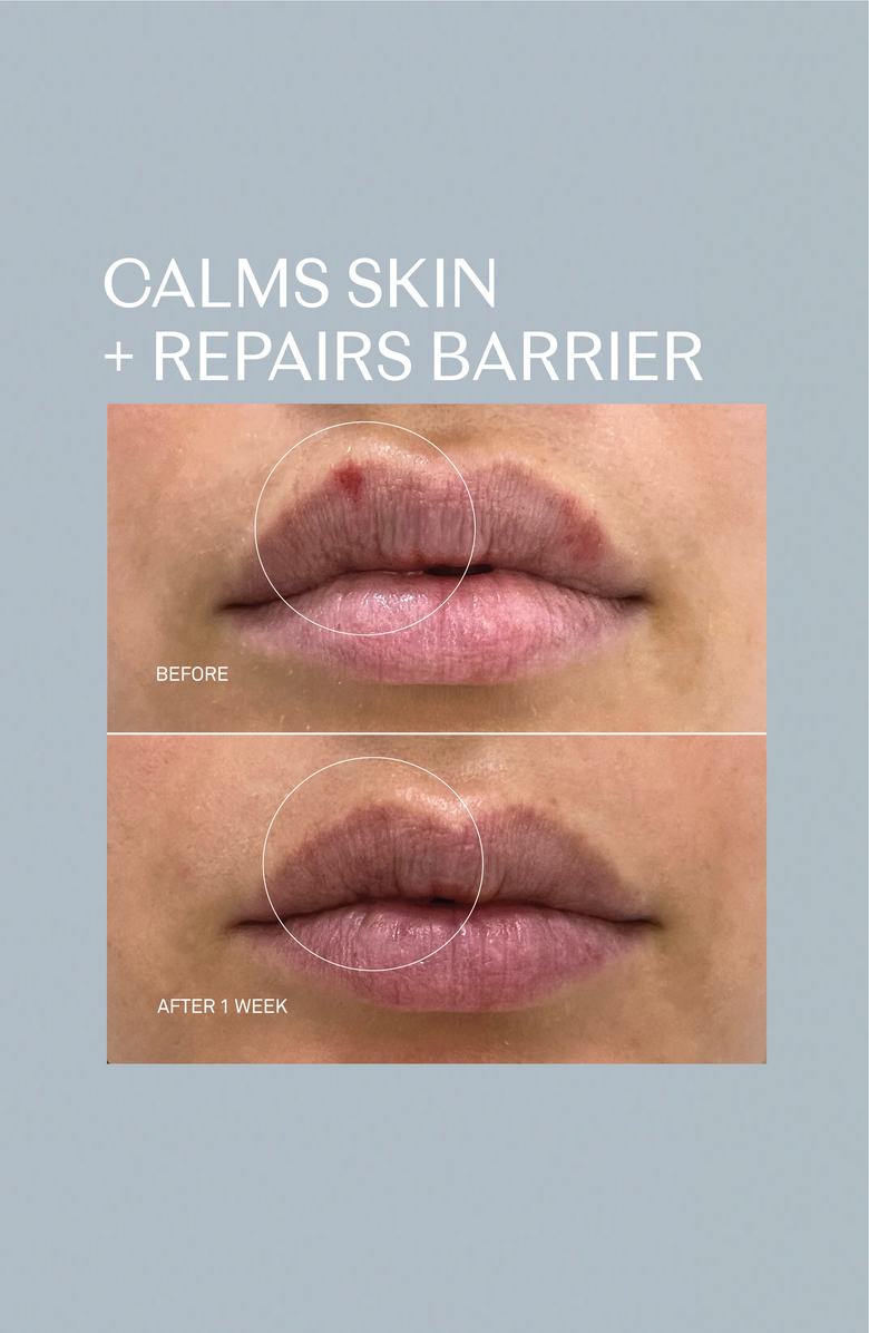 RescueMD Restorative Lip Treatment, Alternate, color, White