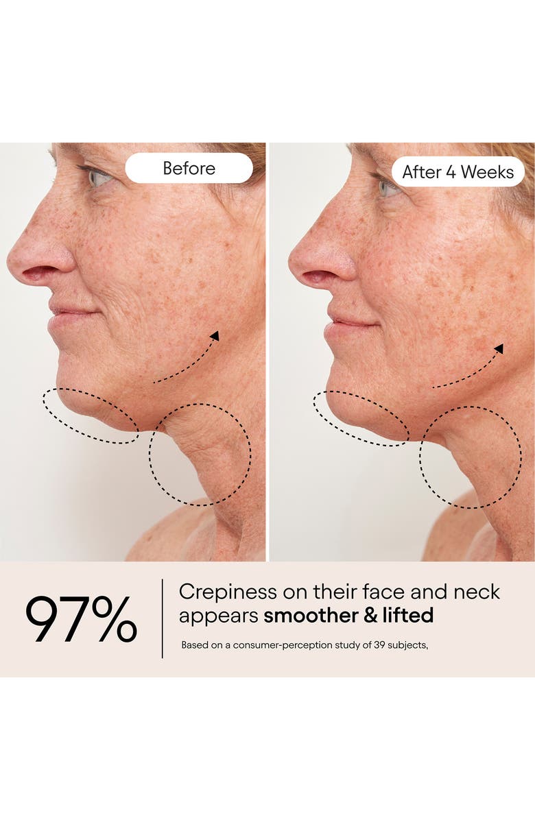 Alpyn Super Sculpt Serum for Face & Neck with Tri-Peptide Firming Complex, Alternate, color, 