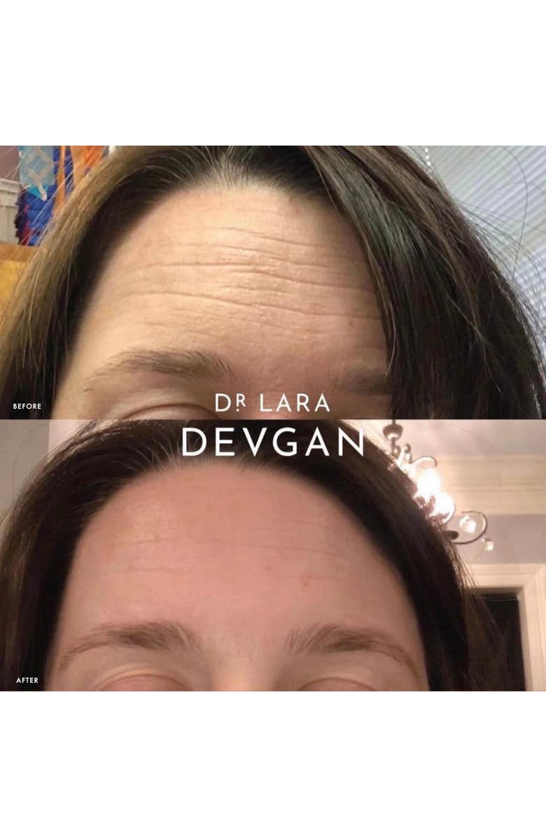 Dr. Devgan Scientific Beauty Hyaluronic Niacin Panthenol Serum, Alternate, color, NO COLOR