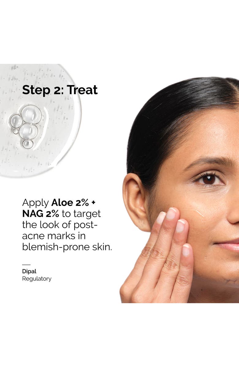 The Ordinary Aloe 2% + NAG 2% Solution for Post-Acne Marks, Alternate, color,
