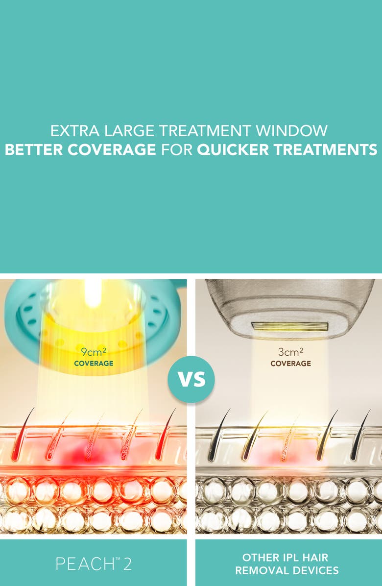 FOREO PEACH<sup>™</sup> 2 IPL Hair Removal Device, Alternate, color, Green