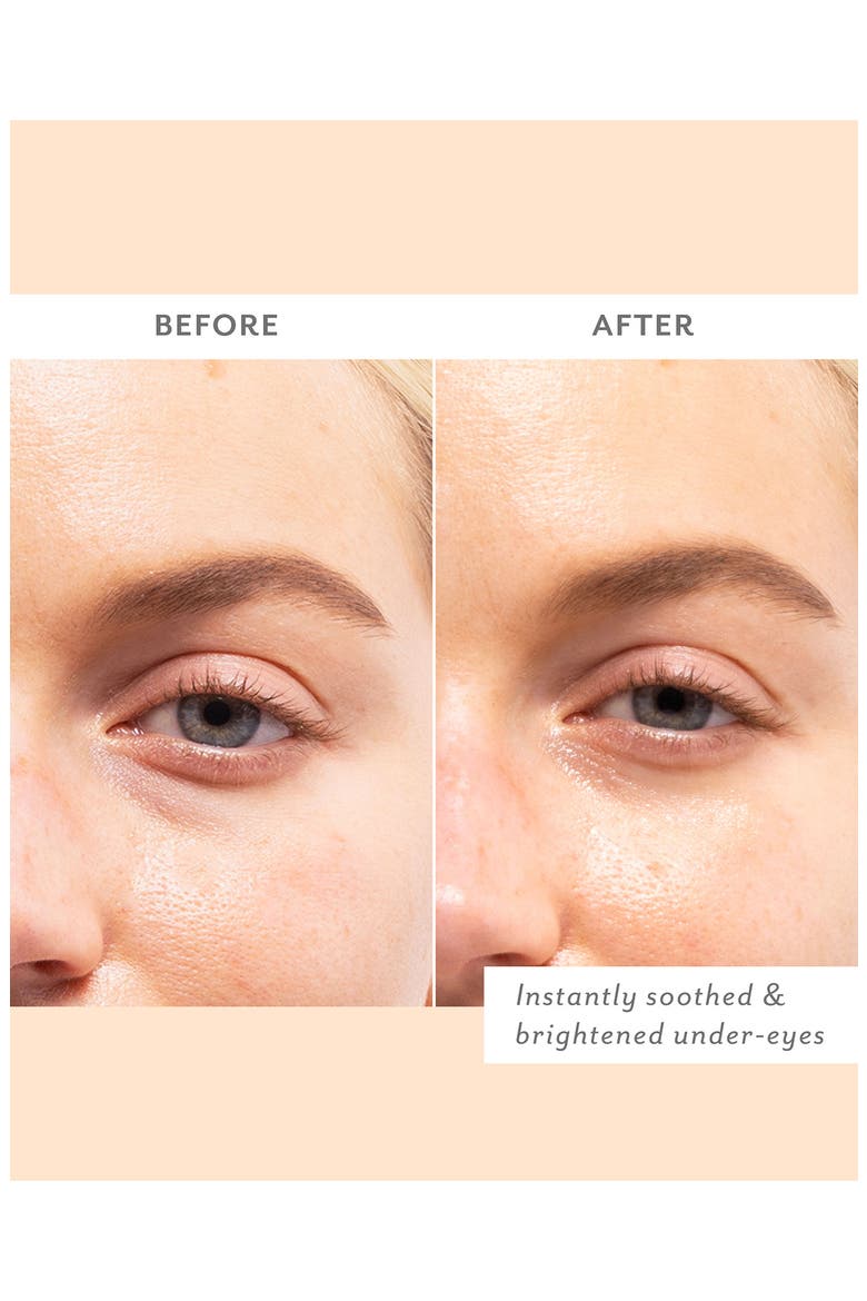 5-Pack Skin Remedy Soothing Eye Gels, Alternate, color, NO COLOR