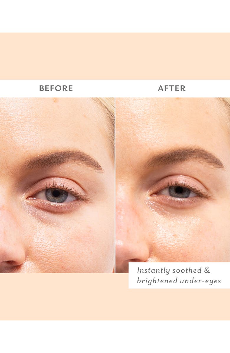 Patchology 5-Pack Skin Remedy Soothing Eye Gels, Alternate, color,