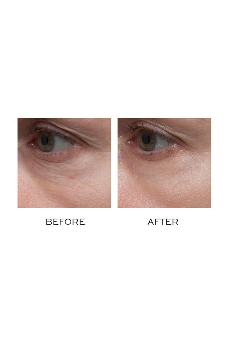 Ultra Smart Pro-Collagen Eye Treatment Nighttime Duo, Alternate, color, NO COLOR