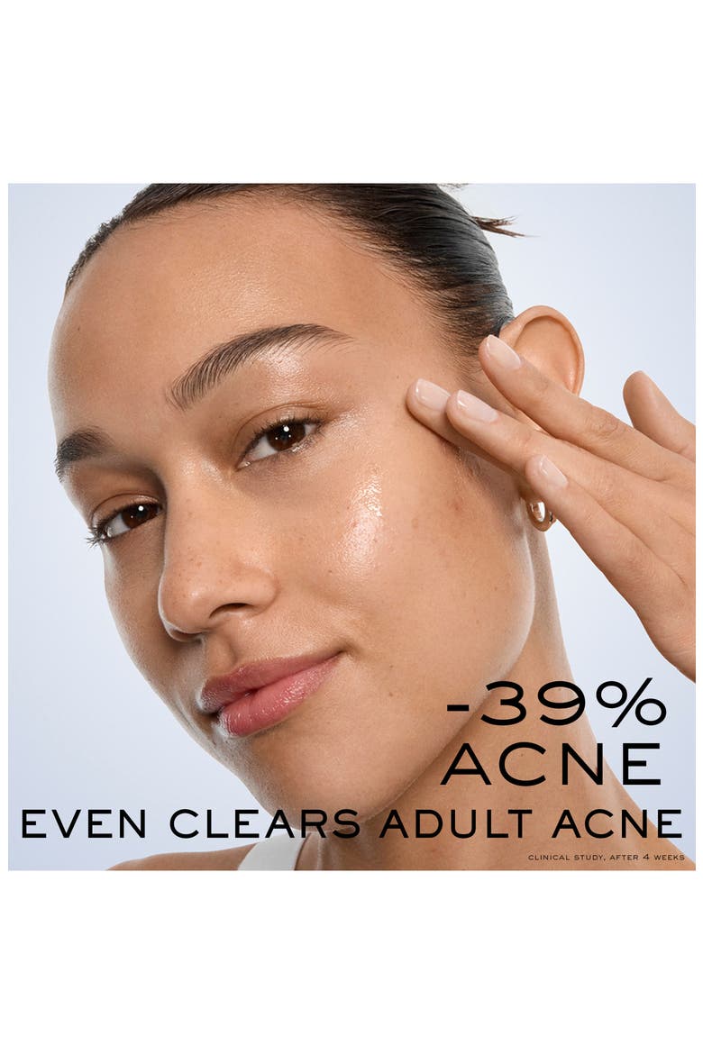 Clarifique Bx-Interceptor Acne Treatment with Glycolic & Salicylic Acid, Alternate, color, NO COLOR
