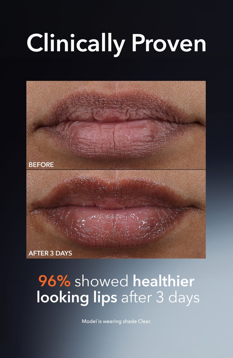 Dr. Dennis Gross Skincare DermInfusions<sup
™</sup
Plump + Repair Lip Treatment, Alternate, color, Clear