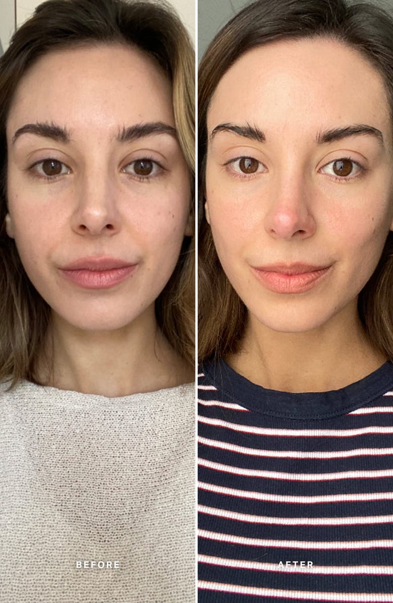 Alpha-H Vitamin C Serum with 10% Ethyl Ascorbic Acid, Alternate, color, 