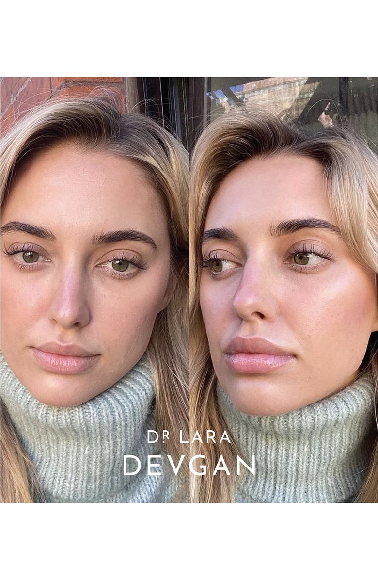 Dr. Lara Devgan Platinum Lip Plump, Alternate, color, 