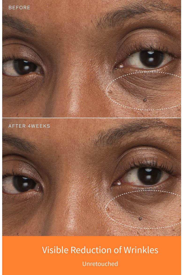 First Care Activating Serum VI Duo (Nordstrom Exclusive) (Limited Edition) $178 Value, Alternate, color, NO COLOR
