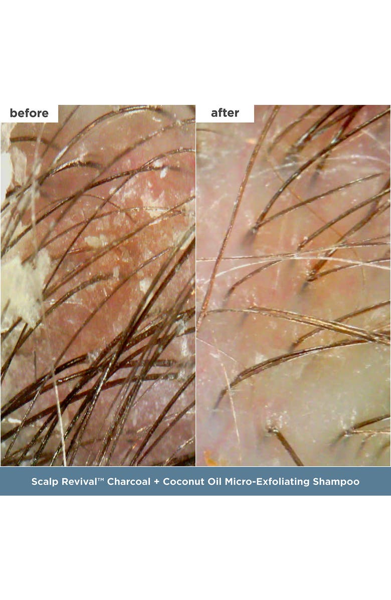 Briogeo Ultimate Hair Heroes Set $81 Value, Alternate, color,