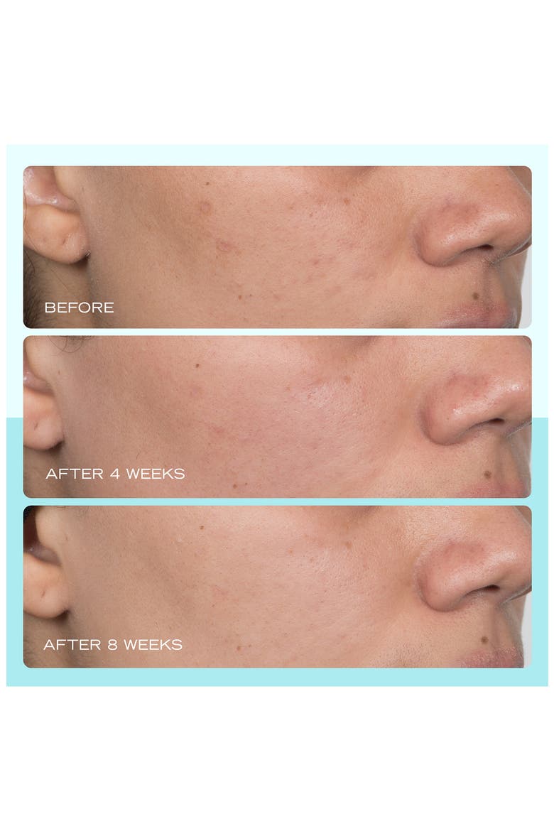 Dark Spot Serum with Niacinamide, Alternate, color, NO COLOR