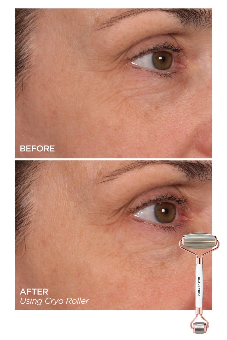 Cryo Dual Roller for Face, Eyes & Body Set $195 Value, Alternate, color, NO COLOR