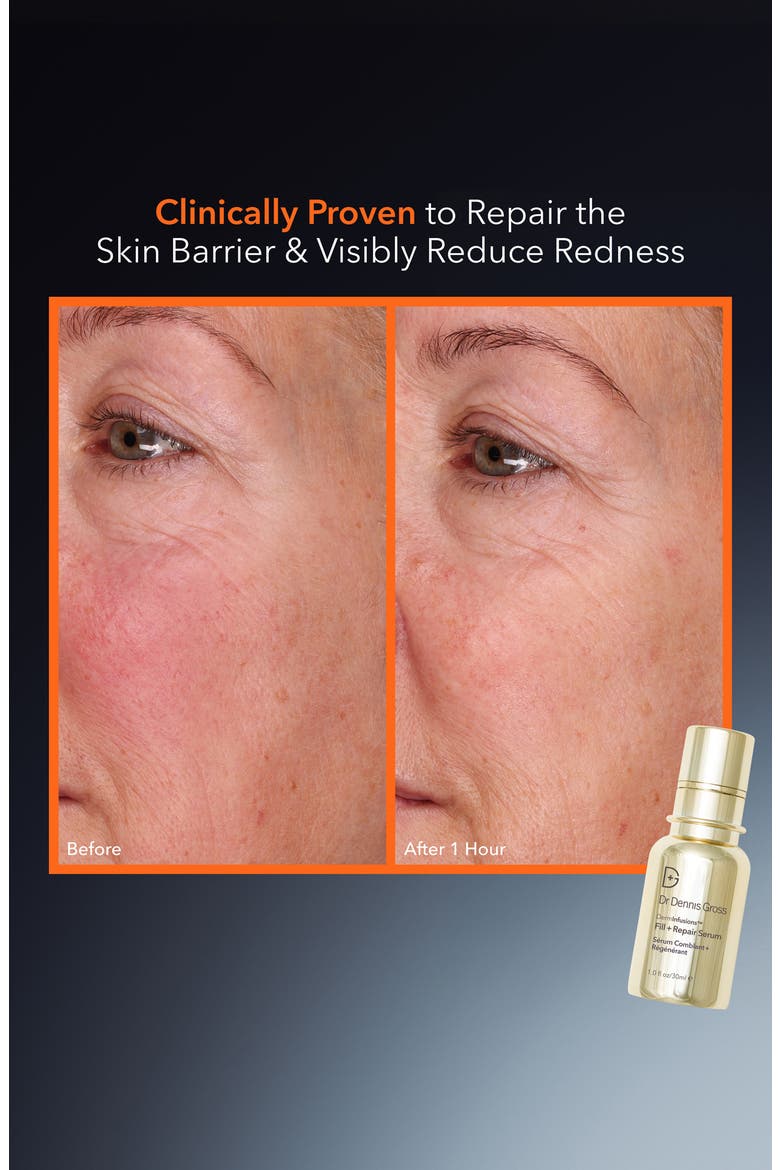 DermInfusions Fill + Repair Serum, Alternate, color, NO COLOR