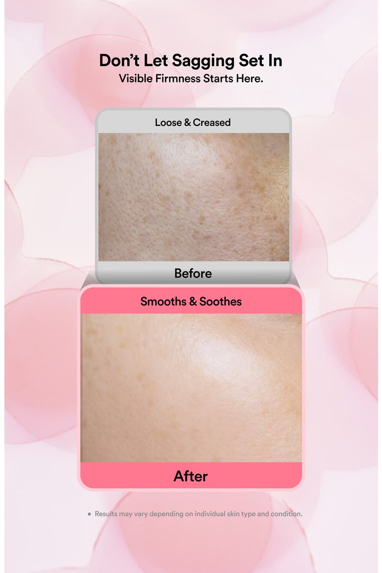 Lifting Glow Face Gel Patch, Alternate, color, NO COLOR