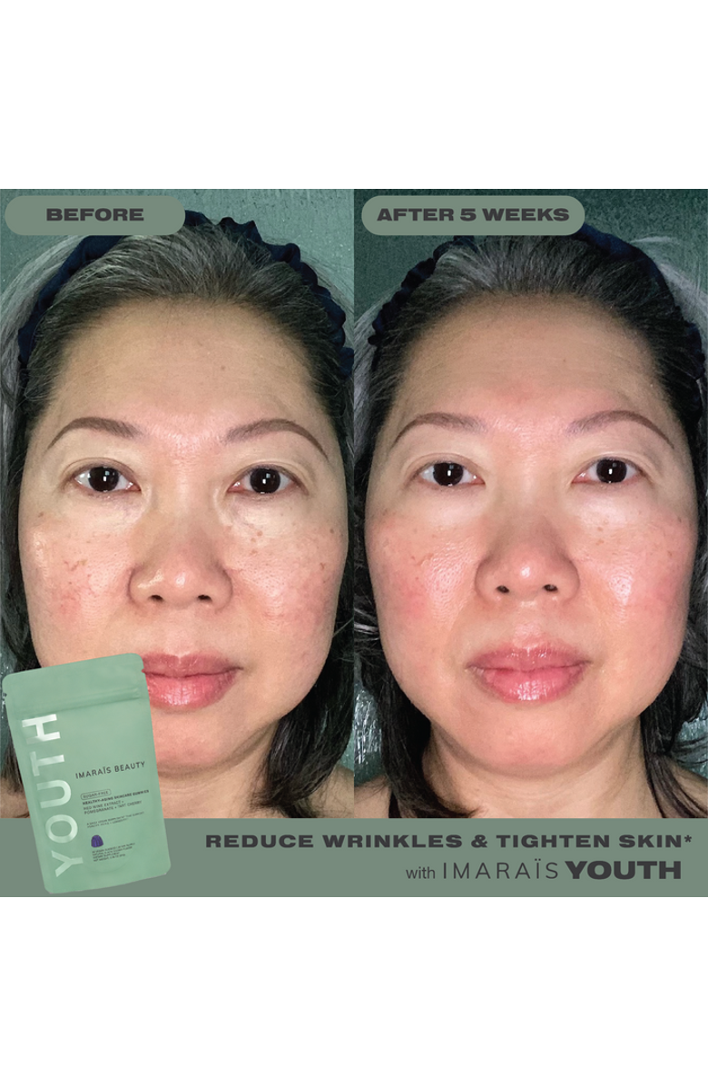 Imarais Beauty Youth, Alternate, color, Green