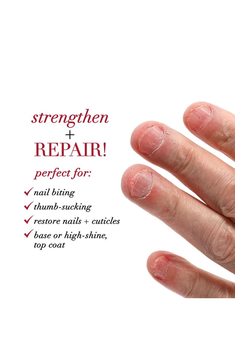 Dermelect RESIST Nail Bite Inhibitor + Restorative Treatment, Alternate, color, Clear