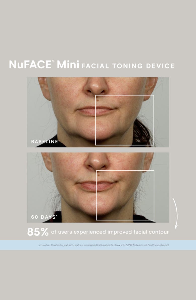 NuFACE<sup>®</sup> Mini Starter Kit $209 Value, Alternate, color,