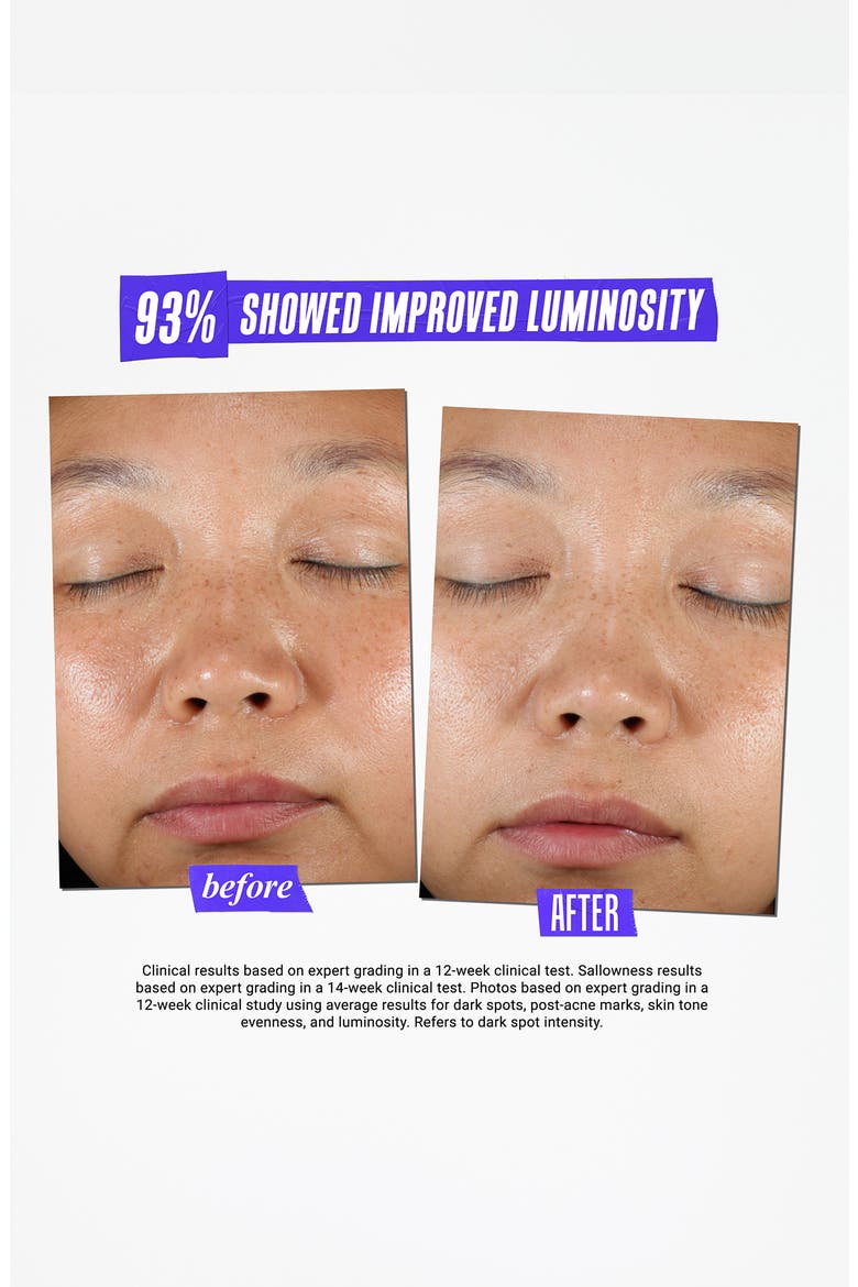 Clearly Corrective™ Dark Spot Solution, Alternate, color, NO COLOR