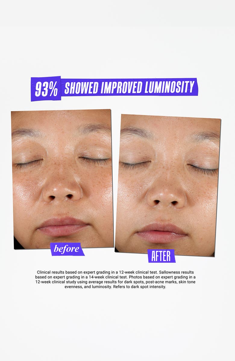 Kiehl's Since 1851 Clearly Corrective<sup>™</sup> Dark Spot Solution, Alternate, color, 