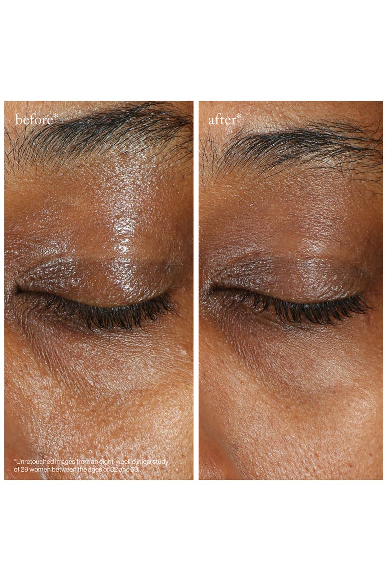 Vita-C Brightening Eye Cream, Alternate, color, NO COLOR