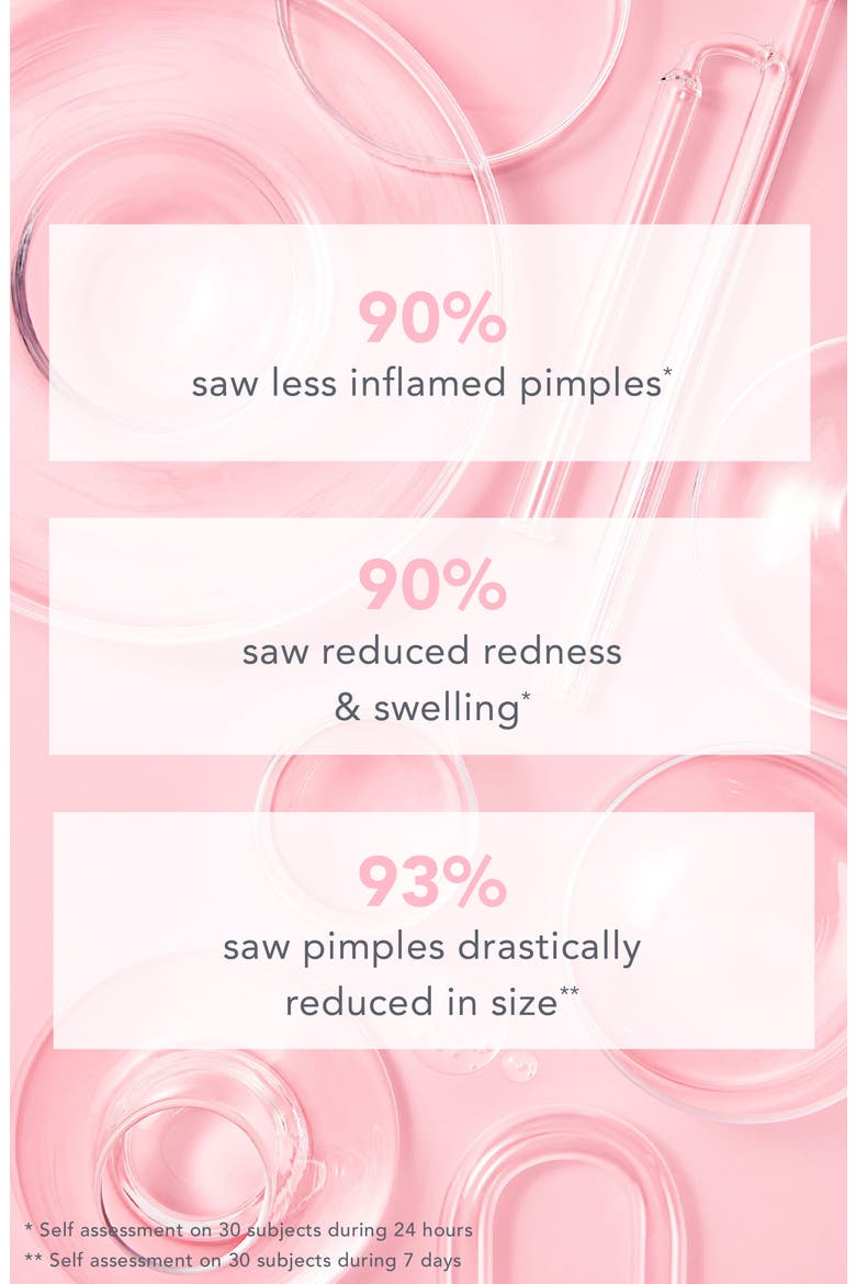 Go Away Acne Spot Treatment, Alternate, color, NO COLOR