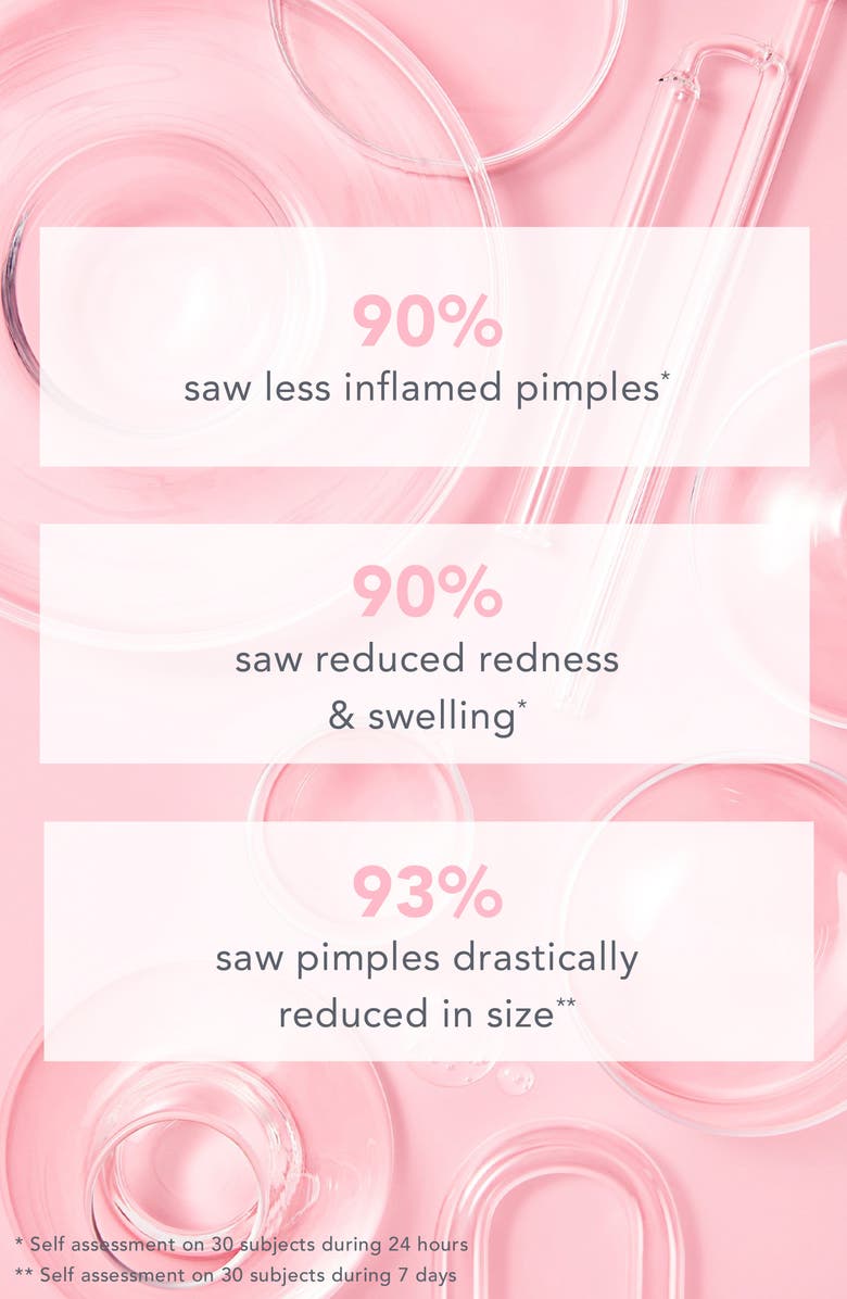 TULA Skincare Go Away Acne Spot Treatment, Alternate, color, 