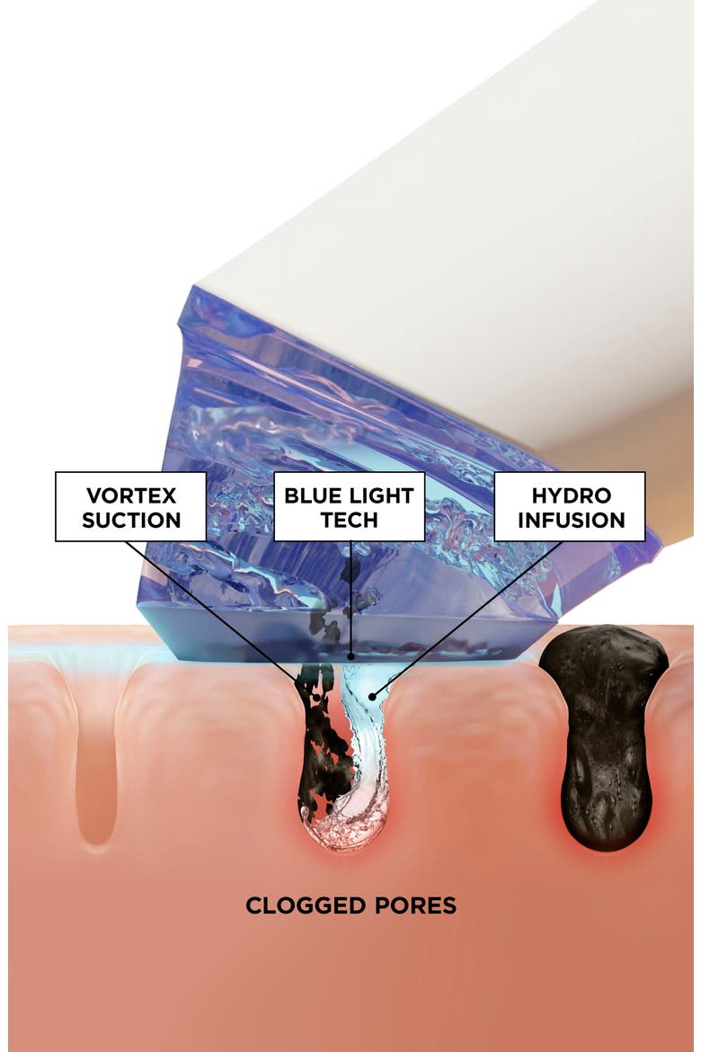 GLOfacial Hydro-Infusion Deep Pore Cleansing + Blue LED Clarifying Tool, Alternate, color, NO COLOR