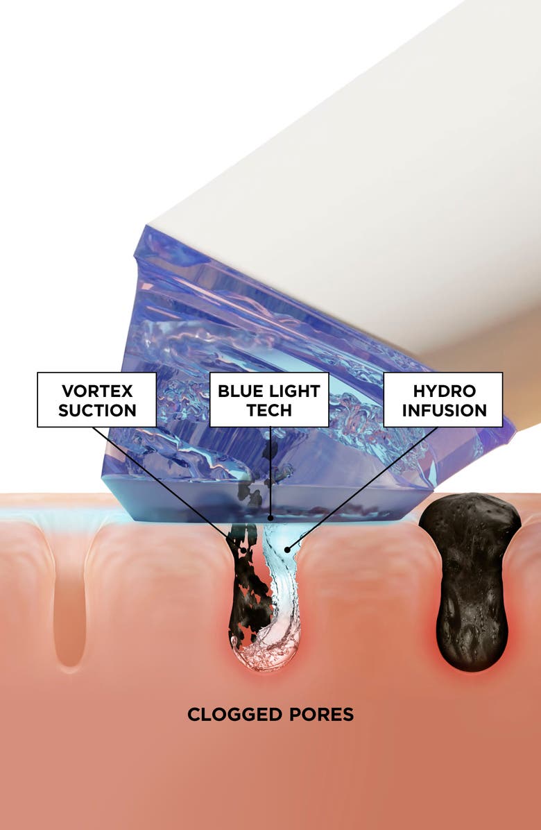 BeautyBio GLOfacial Hydro-Infusion Deep Pore Cleansing + Blue LED Clarifying Tool, Alternate, color, 