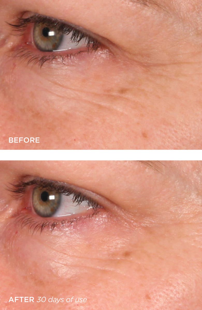 BeautyBio The Quench Eye Reviving Eye Balm, Alternate, color,