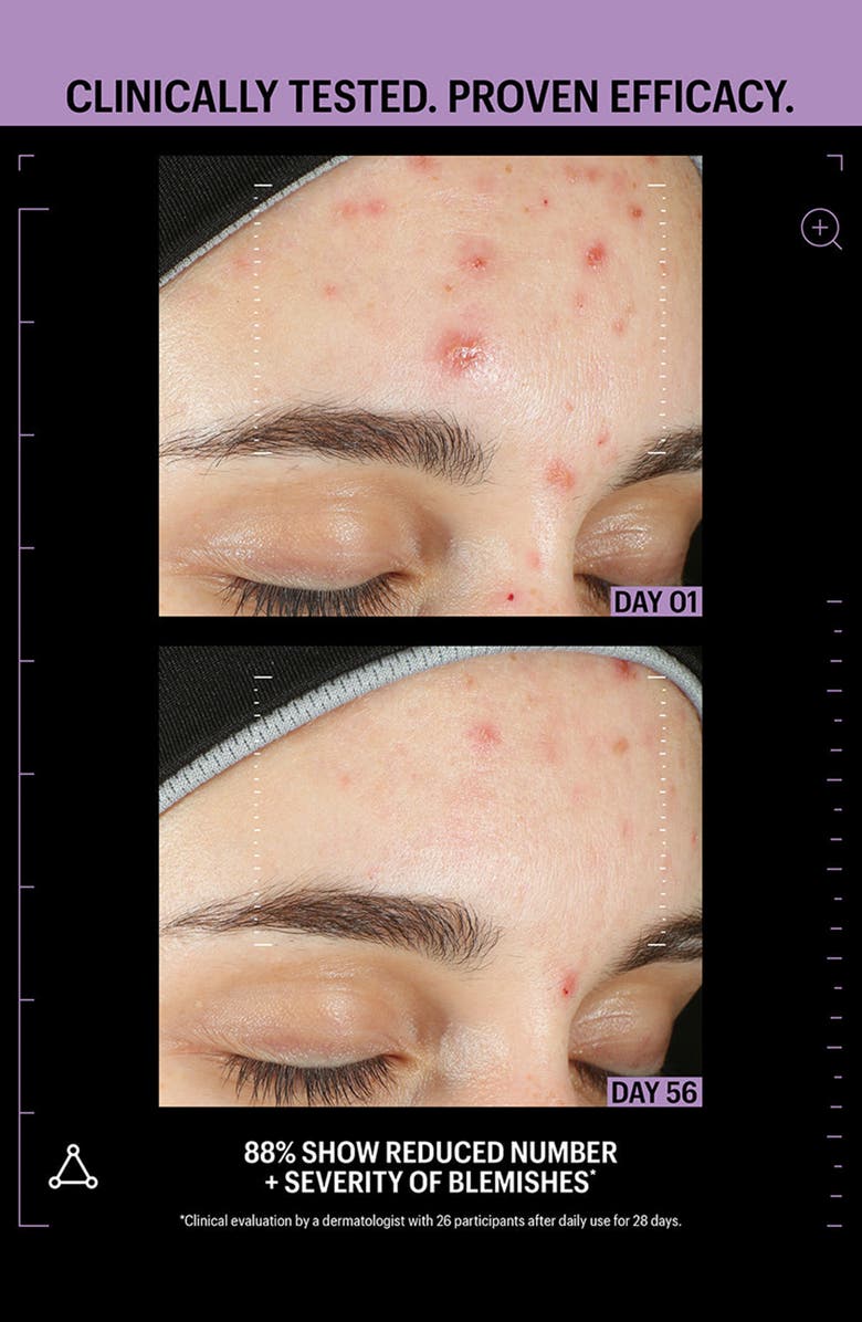 ALLIES OF SKIN Azaelaic & Kojic Advanced Clarifying Serum, Alternate, color, 