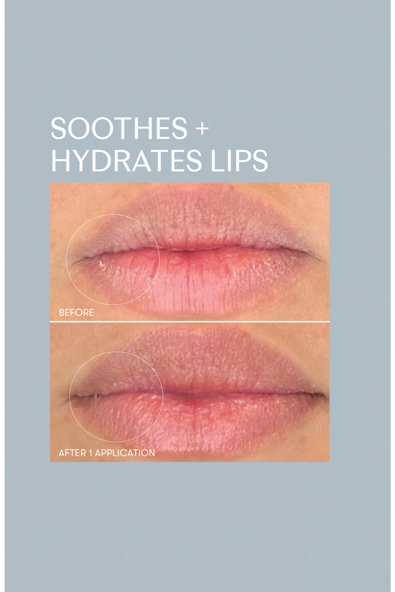 Restorative Lip Treatment, Alternate, color, White