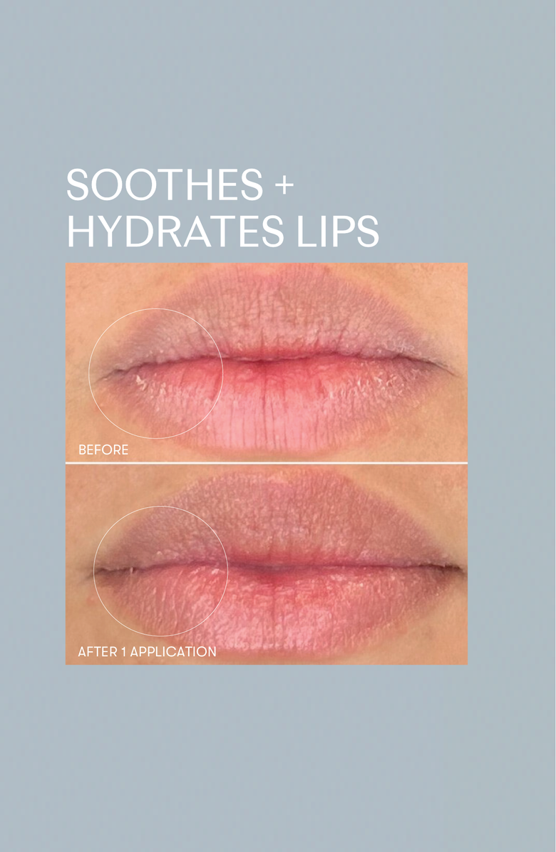 RescueMD Restorative Lip Treatment, Alternate, color, White