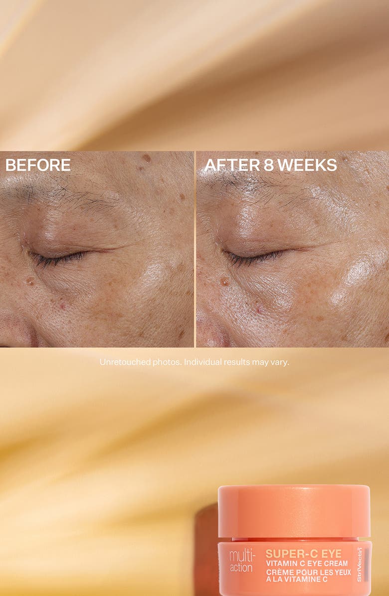 StriVectin<sup>®</sup> Multi-Action Trio: Brighten & Restore $98 Value, Alternate, color,