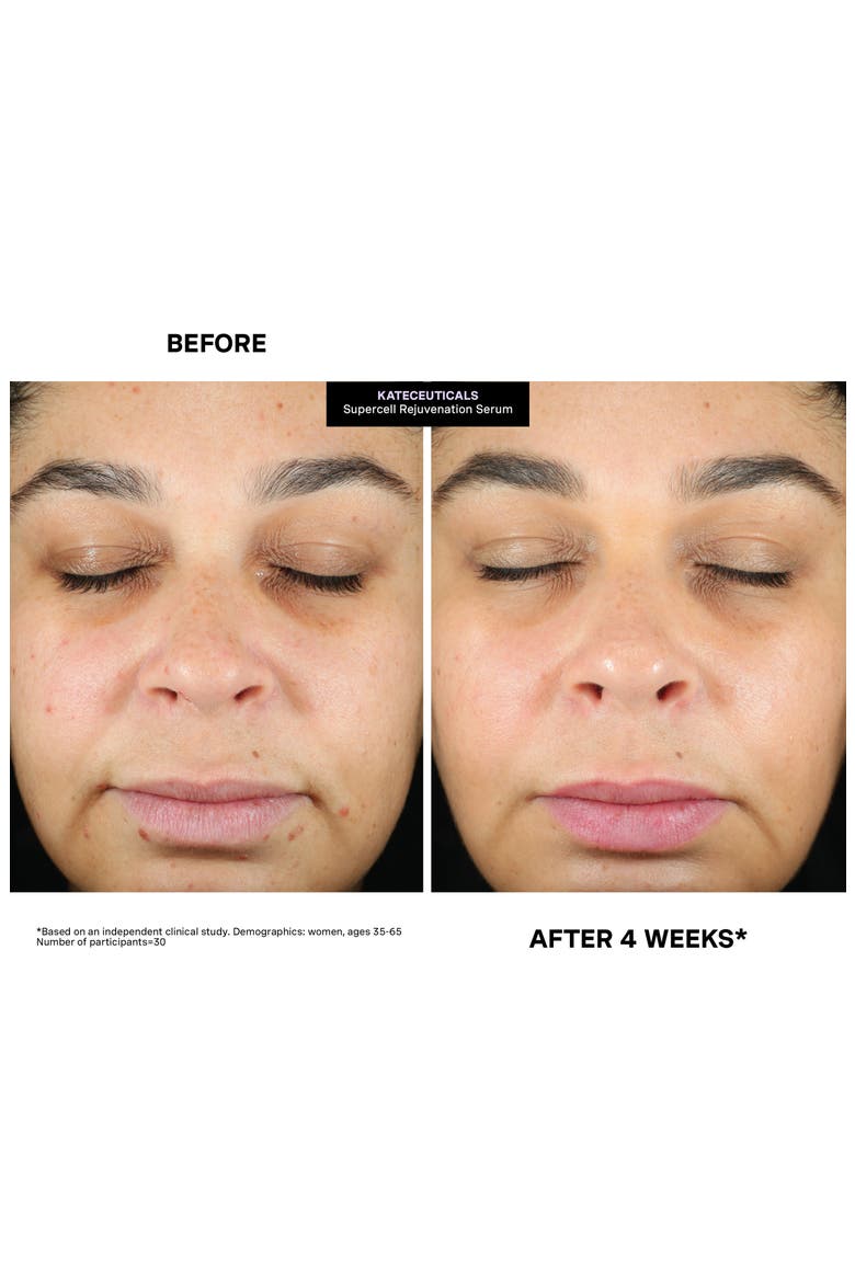 KateCeuticals SuperCell Rejvenation Serum, Alternate, color, NO COLOR