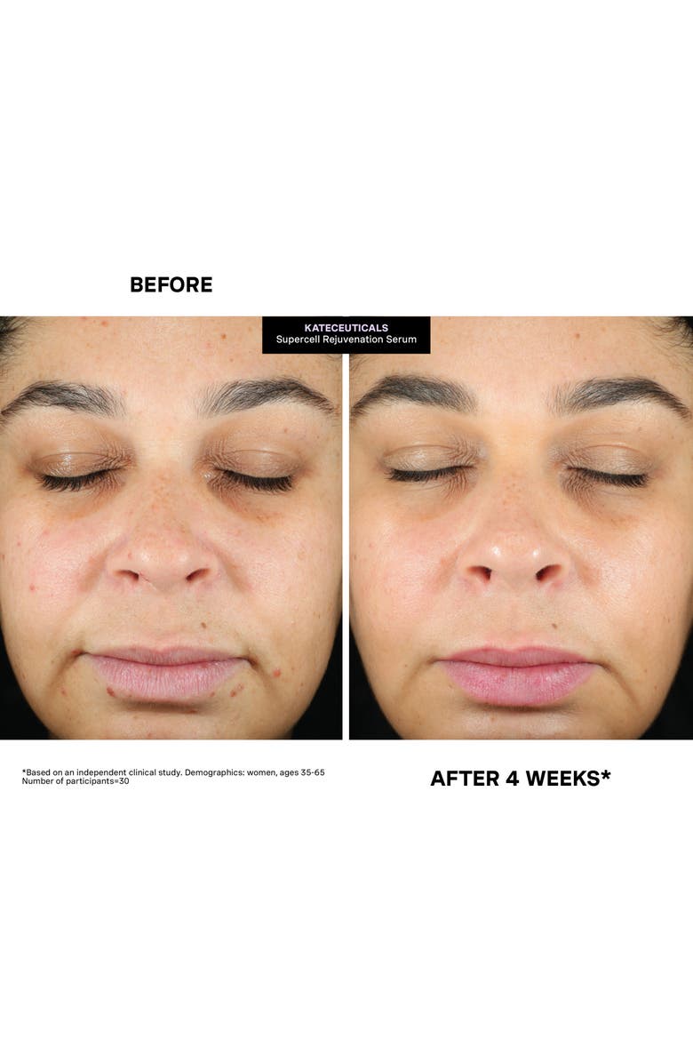 Kate Somerville<sup>®</sup> KateCeuticals SuperCell Rejvenation Serum, Alternate, color, 