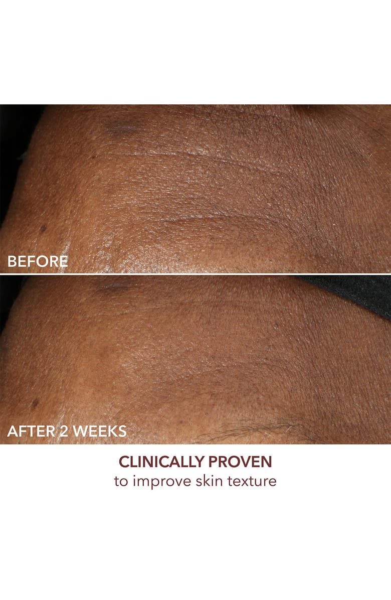 Dr. Dennis Gross Skincare Advanced Retinol + Ferulic Intense Wrinkle Cream, Alternate, color, 