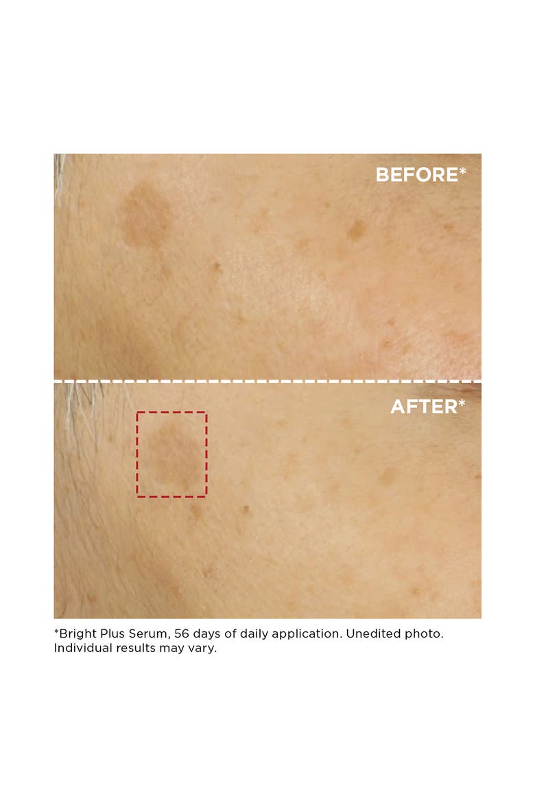 Bright Plus Advanced Brightening Dark Spot & Vitamin C Serum, Alternate, color, NO COLOR